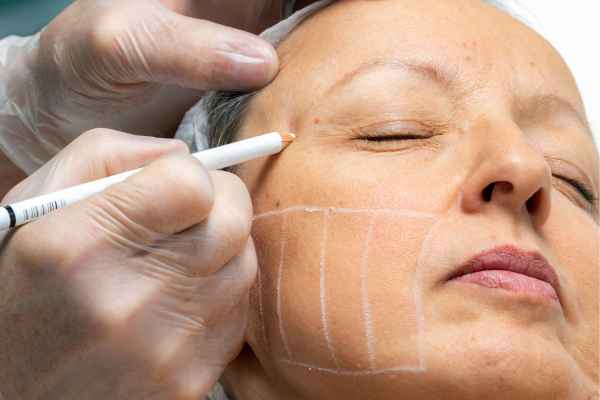 CryoPen: 5 Skin Concerns It May Be Used to Treat 4 What should you ask before having CryoPen treatment Ross on Wye?