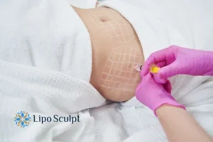 Are The Results From Aqualyx Permanent? 1 Do you want to know how long Aqualyx Ross on Wye results last?